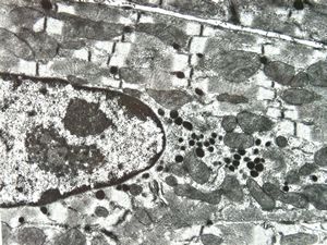 mouse heart atrium … granules of the natriuretic peptide mouse heart atrium … granules of the natriuretic peptide